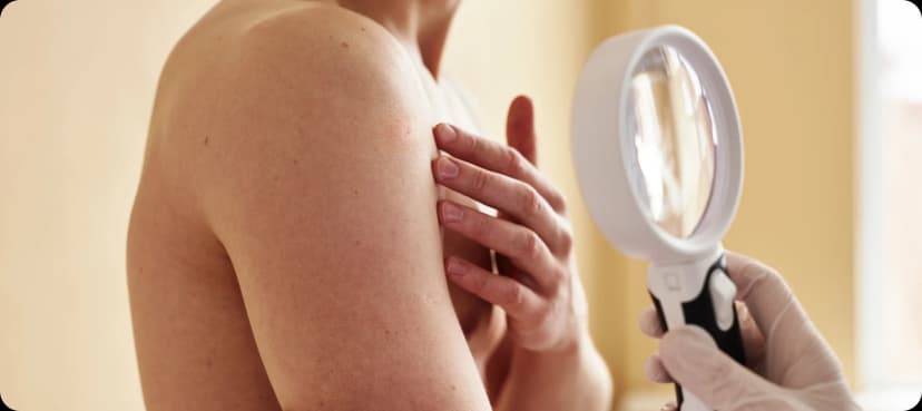 الإجراءات الجلدية البسيطة