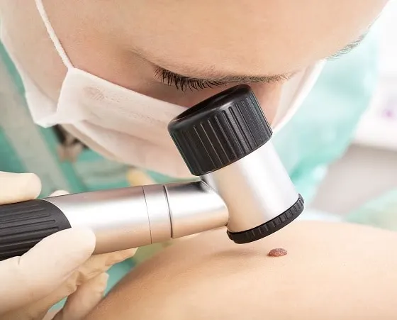 فحص الجلد والتشخيص المبكر